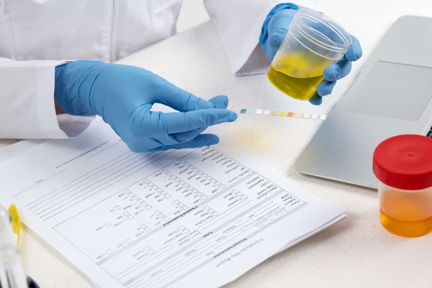 Canada Immigration Medical Exams